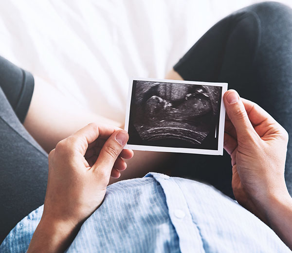Ultraschallbild eines Ungeborenen in den Händen einer Frau